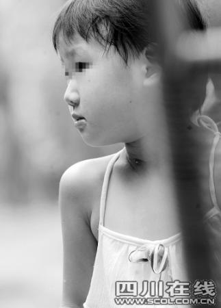 4岁女孩手术后脖上长洞喝水从伤口流出图