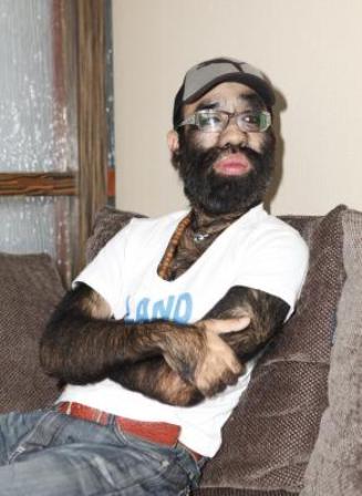 "中国第一毛孩"欲脱毛 落选"新西游"不甘心(图)