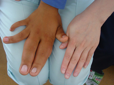 湖北石首10岁男童患巨指症 手指肥大如香蕉(图)