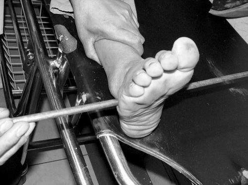 男孩工地寻父遭钢筋穿脚 无大碍入院一天即出院