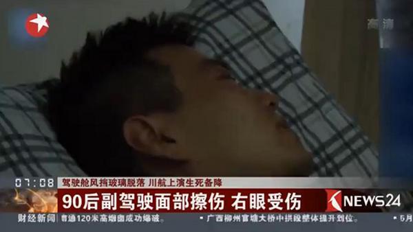 川航上演生死备降 90后副驾驶面部擦伤