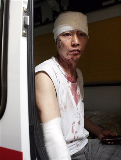 俄罗斯的"光头党现象"