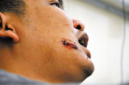 三名歹徒清晨当街持枪抢劫 与便衣警察驳火(图)