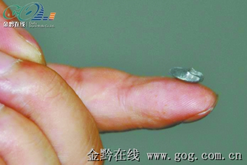 信鸽体内发现的铅弹