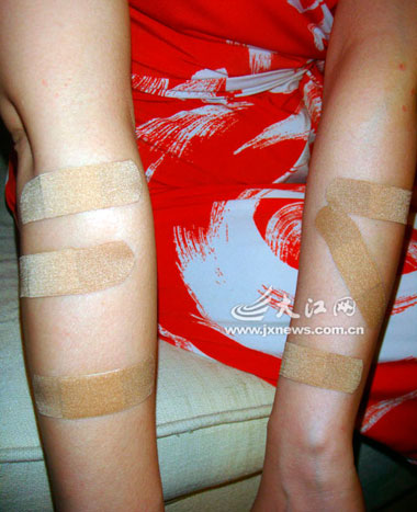 来自上海的游客赵女士在庐山西海温泉假日酒店鱼池做鱼疗时受伤,还见