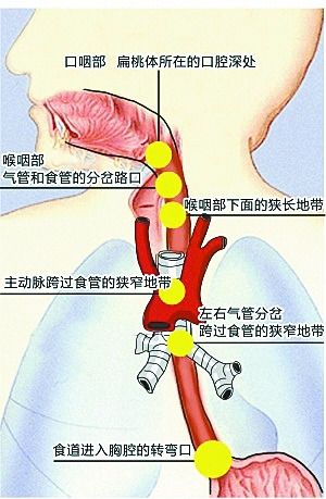 食管与气管位置图图片