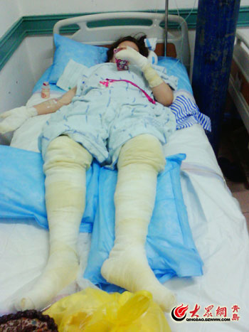 青岛一游船因故障突然爆炸 15名游客受伤(图)