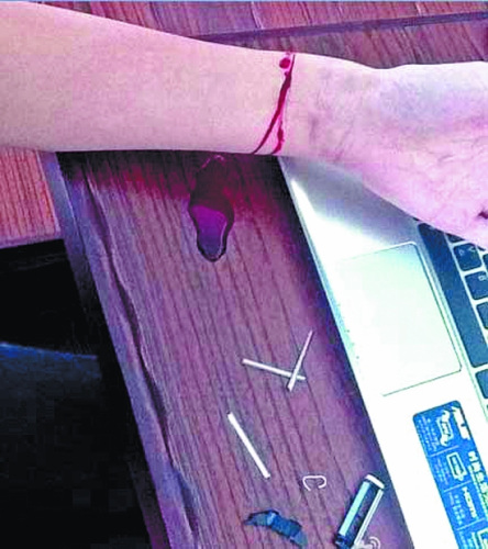 Ů��΢��ֱ��������ɱ���ѱ�����ʱ��ֹ��ͼ��