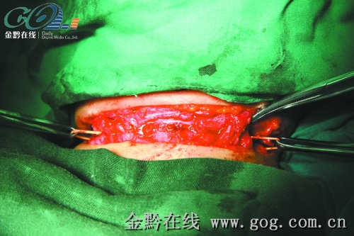 3���к����ӡ���������ɫ�̺���Ƥ�������