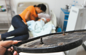 一岁男婴从床上掉下来螺丝钉扎进头里2厘米(图)