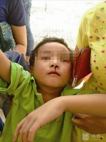 ����19��Сѧ��ͻ����Ѫ:��ȾԴ��Ѱ��ظ��Σ�ͼ��