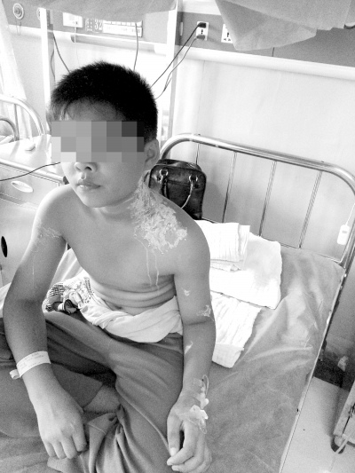 高压线掉火花烧伤12岁学生疑因电线短路所致