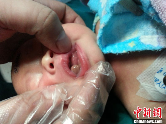 ��������ŮӤһ������ġ���ͷ�����ɹ��г�