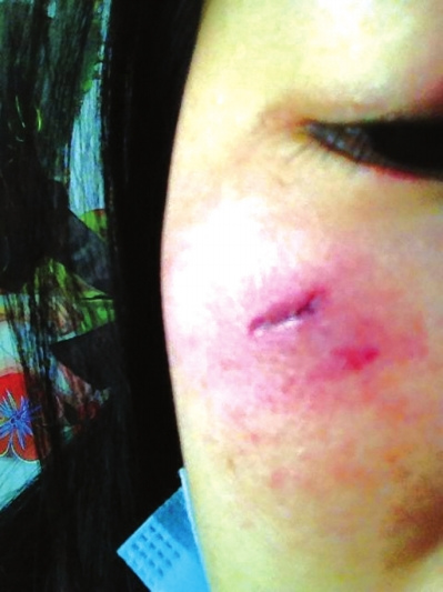 女子夜场兼职推销酒水 拒绝陪酒被醉汉砸破脸(图)