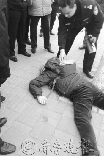 ���ӽ�ͷ�ε���ѧ����Ԯ����ҽ������Ч����