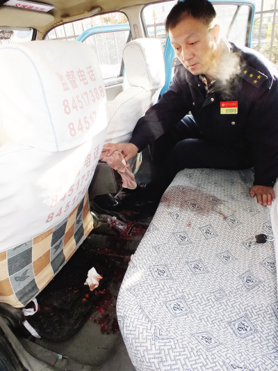 Ů�ӱ�����ײ���ڱ���Ѫ�����ĸ�Ľ������Ԯ