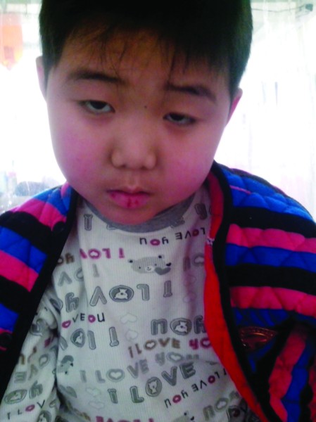 男孩罹患白血病全村相救家人至今没告诉孩子真相