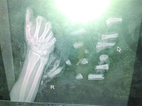 Ů�����ֱ��ʳ�13��10��ҽ����15Сʱ��ȣ�ͼ��