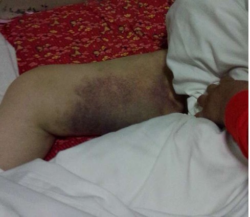 ��Ѯ��̫�������ۼ������ɱ�������Ժ��ϵˤ��