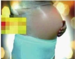 ���������轺��Ƥ���и�Ϊ����������������ͼ��