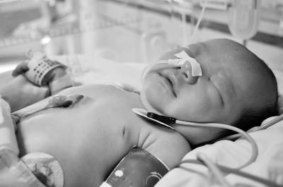 新生儿心脏“漏”在外裸露28天后被医生送回胸腔