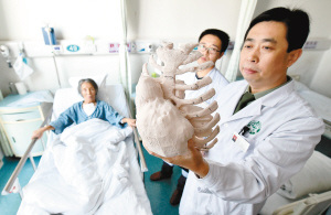 3D��ӡ��������78�����˸�̾��̫���桱