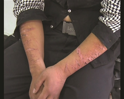 小伙为情所困自残40多刀 跳楼轻生被拉回踢打恩人