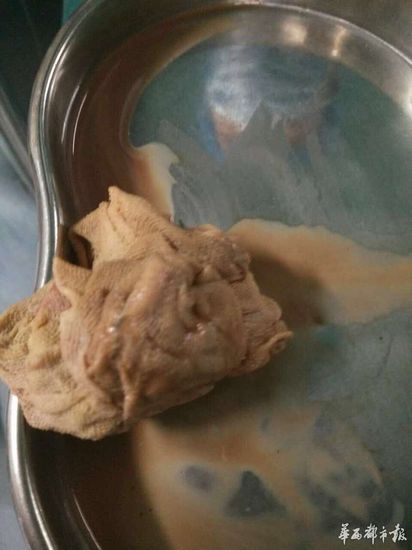 Ů�Ӳ���ɴ��������ʹ������ʦ��ҽԺӦ�⳥��ͼ��