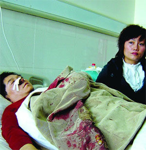 公安局副局长空手擒持刀凶徒被扎烂鼻孔(图)