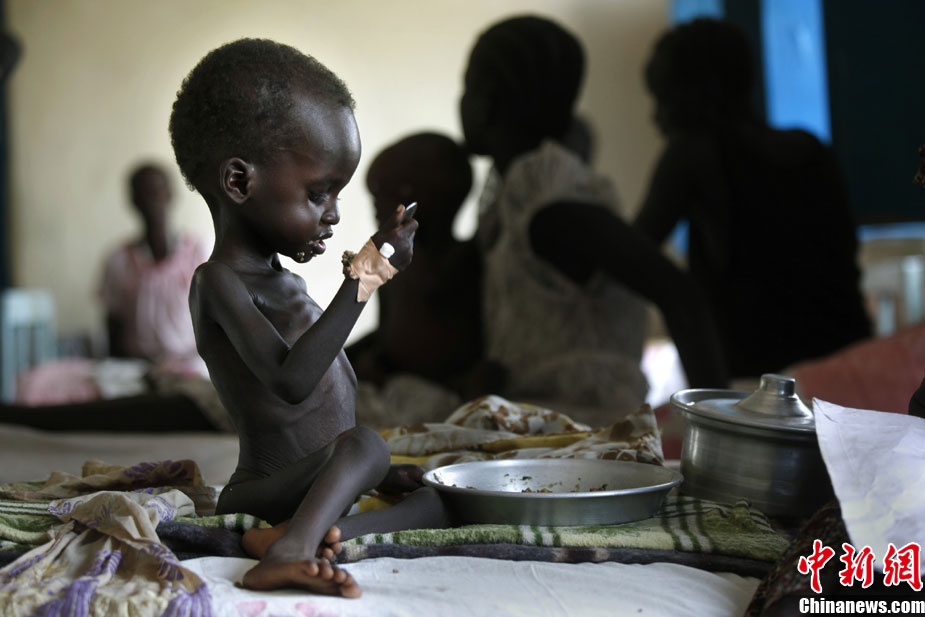 4月8日,苏丹,一名儿童正在医院的病床上吃东西.