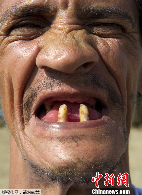 哥伦比亚举行"丑男大赛" 冠军可获550美元奖金