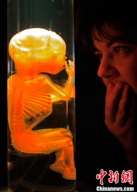 匈牙利布达佩斯举行塑化人体展 (5/6) 全屏观看"←→" 可以实现快速