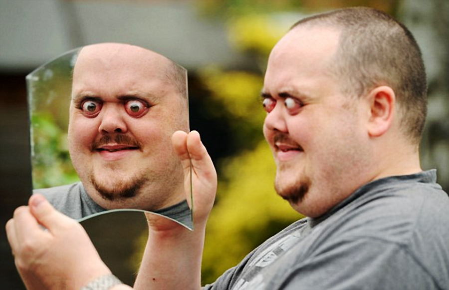 英男子眼睛可瞪出12毫米网友们都惊呆了