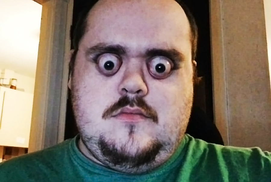 英男子眼睛可瞪出12毫米 网友们都惊呆了