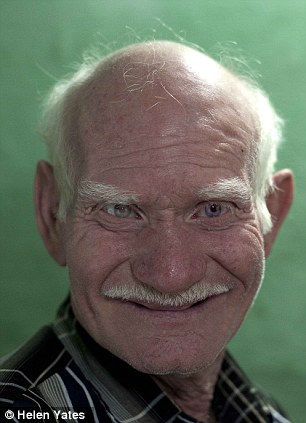 印度奇特家族成世界最大白化病家庭