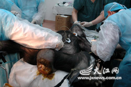 南昌动物园黑猩猩接受人工授精(11)