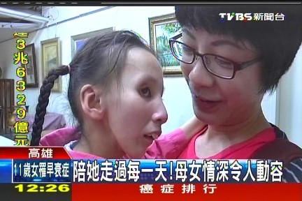 早老症爱女11岁像77岁台湾母亲坚毅呵护(图)