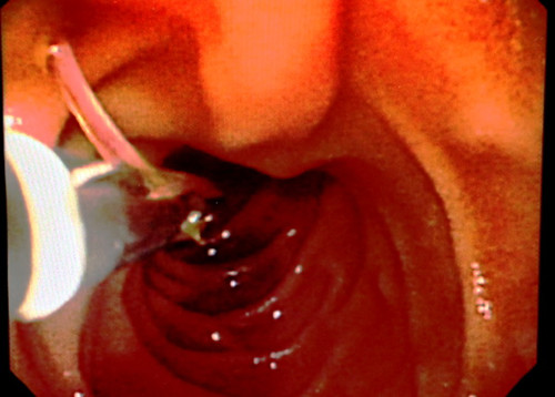 3������̴̴�ʮ��ָ���¸�Ĥ��ҽ��̾����