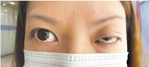 ׼������ⶾ�˾�������С�ۺ��Ī����ͼ��