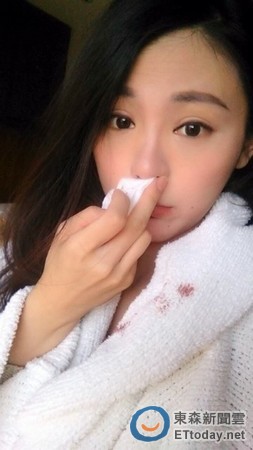 台美女主播在京不适应天气流鼻血粉丝心疼献计