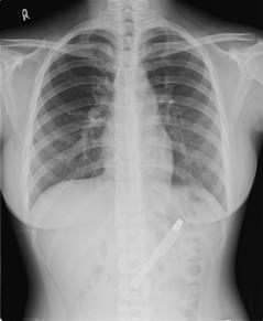 ��Ů��10���ֱָ����¶ǰ����ȡ���ʱ�θ�ḯʴ