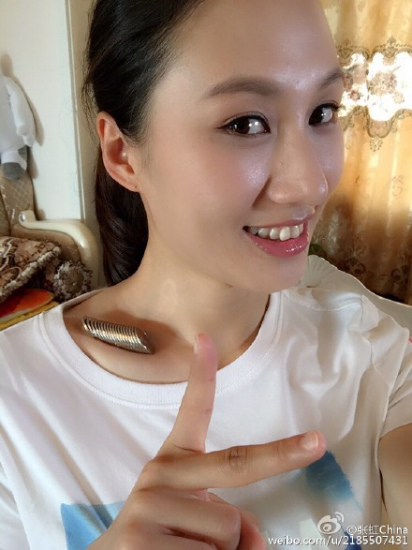 速滑女神张虹锁骨放硬币 打趣:是证明骨头大嘛(4)