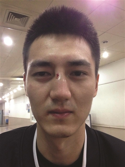 江苏同曦三连败且损兵折将宋建骅鼻梁又被打断