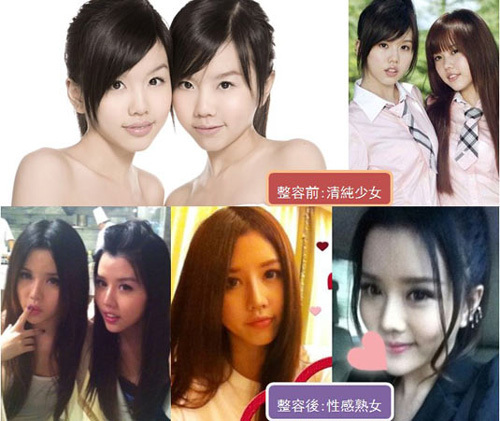 by2"整容结婚"风波掀骂战 指莫熙儿"昧良心乱掰"