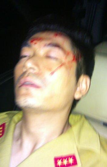 ��Ա��Ӿ����Ϸ������ͷ��ײ��ʯ�鵱�����ʣ�ͼ��