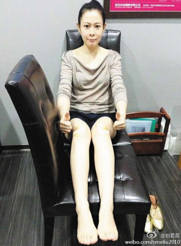 刘若英忍痛治疗膝盖 晒治疗细节照 秀美腿(图)