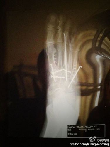 ������ɹ�иֶ��Ų�X��������Ƥ�Ի���٩��ͼ��