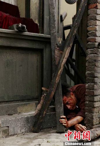 �����纮�������ع����ͷ��Ѫ������ͼ��