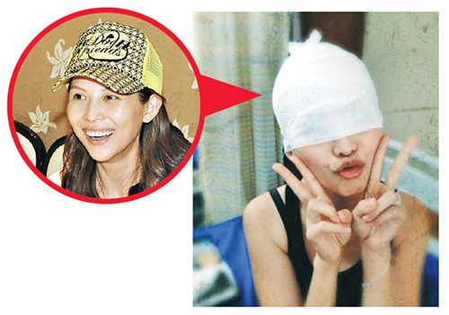 蔡少芬晒纱布包头照双眼被掩盖笑称“神秘”(图)