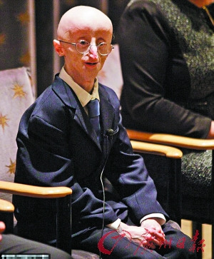 �����ϻ�ͯ��17�ꡰ��˥���ꡱȥ����ͼ��